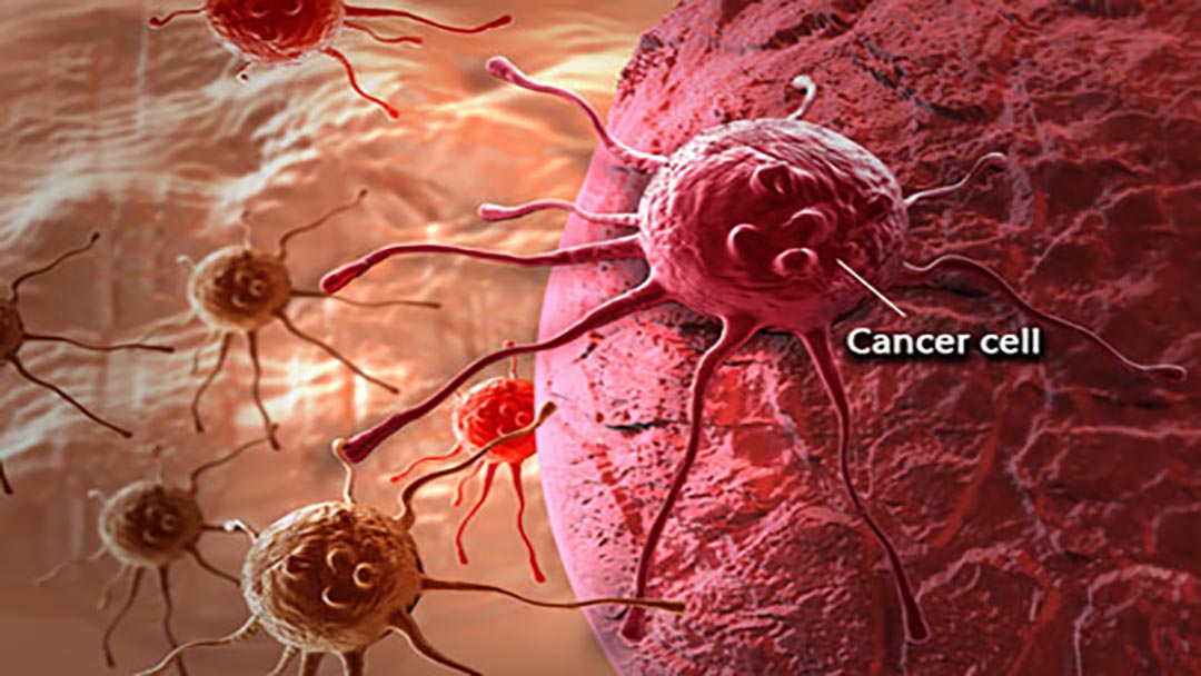 Cancer (Meaning, Symptoms, Causes and Prevention)